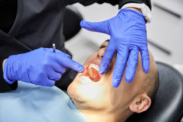 Best Emergency Treatment for Dental Infections or Abscesses in Cecil Bishop, PA